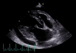心臓血管肉腫による心タンポナーデ。松原動物病院 腫瘍科
