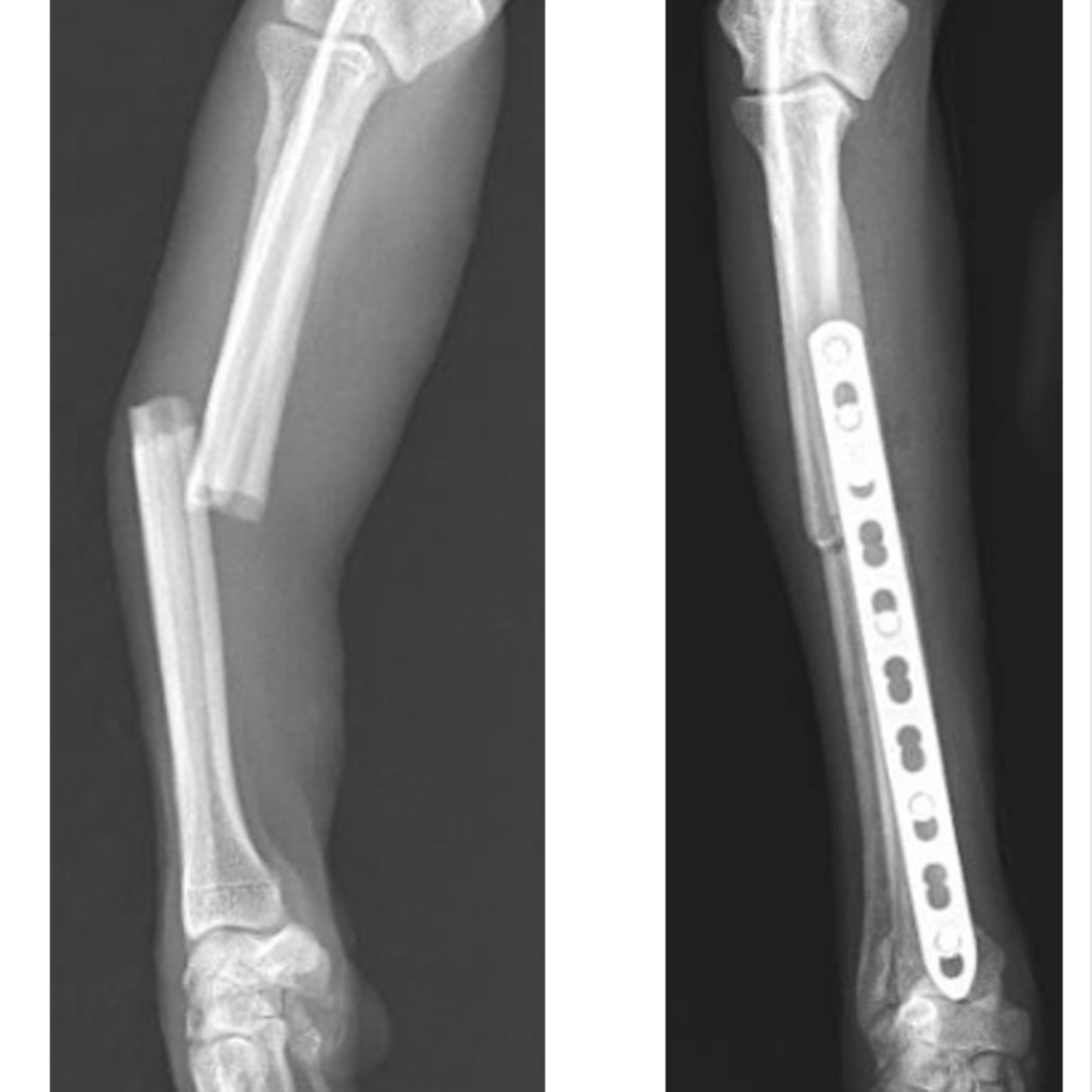 犬の橈尺骨骨折