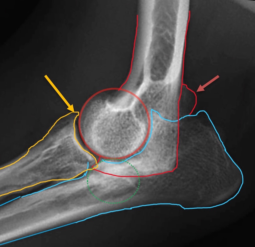 犬の肘異形成症(内側鉤状突起疾患を中心に)
