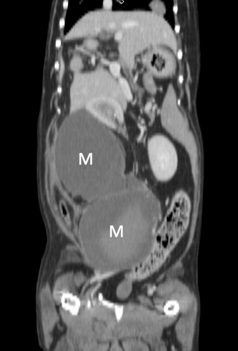 犬の肛門嚢アポクリン腺癌