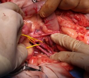 腰下リンパ節群の切除が完了したところ。松原動物病院 腫瘍科